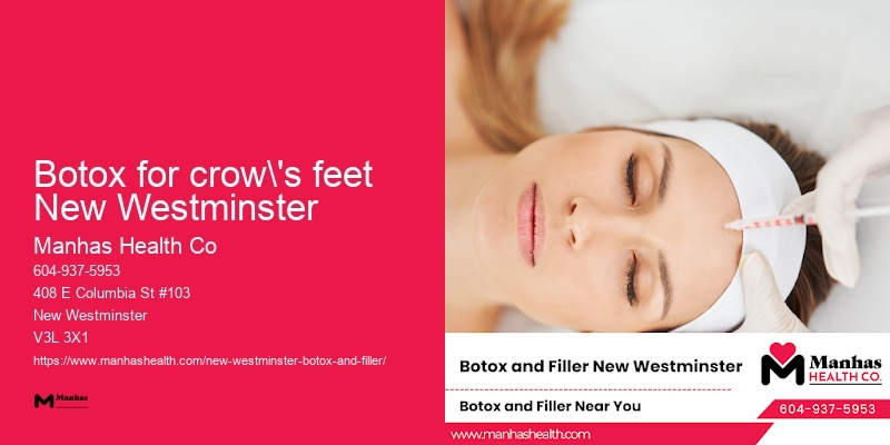 Safe Botox procedures Botox for crow's feet New Westminster