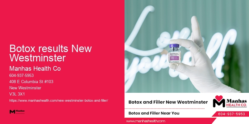 Botox for women Botox results New Westminster