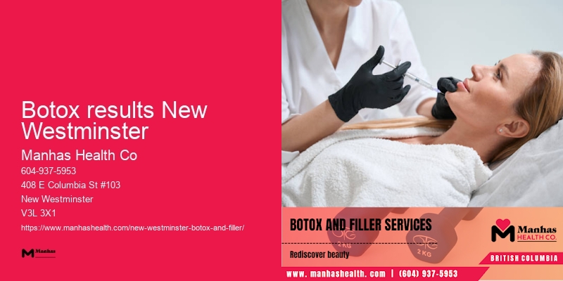Botox injection sites Botox results New Westminster