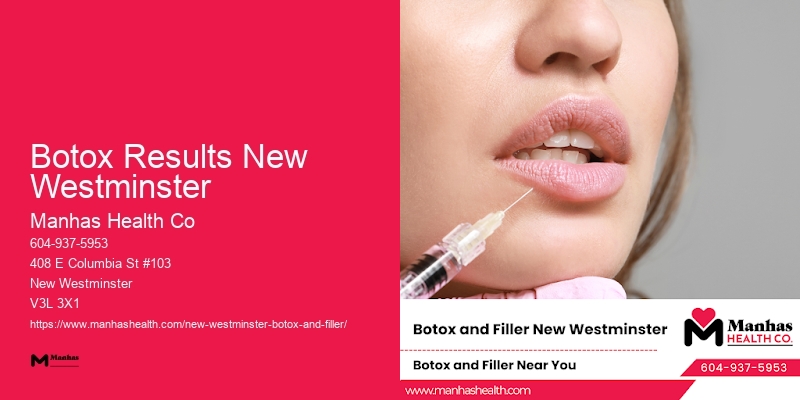 Trusted Botox clinics Botox Results New Westminster