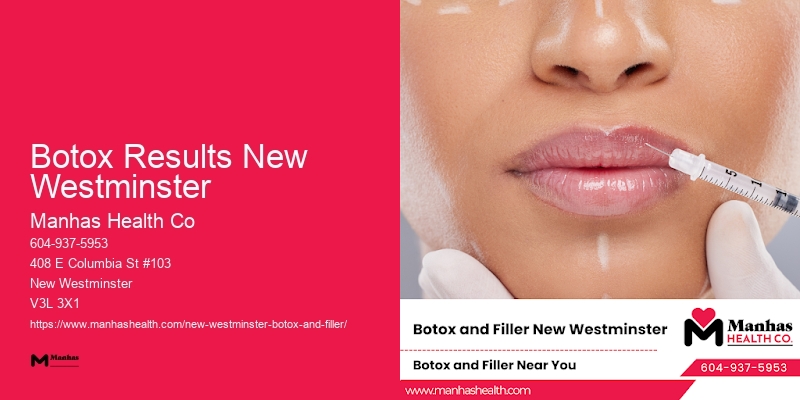 Botox walk-in clinics Botox Results New Westminster
