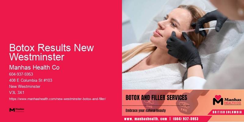 Non-surgical Botox Botox Results New Westminster