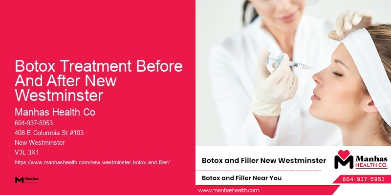 Botox to reduce aging signs Botox Treatment Before And After New Westminster