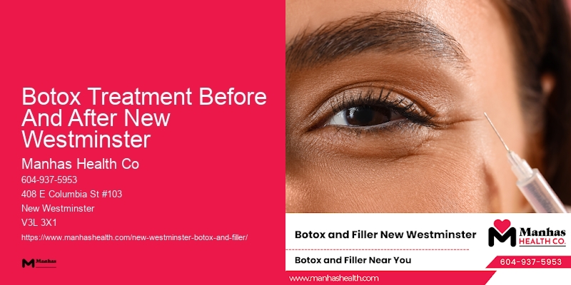 Botox pain management Botox Treatment Before And After New Westminster