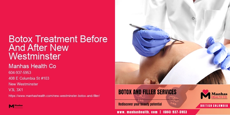 Botox facial line treatment Botox Treatment Before And After New Westminster